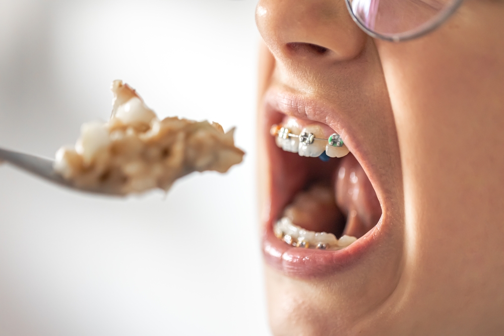 Person eating with braces.